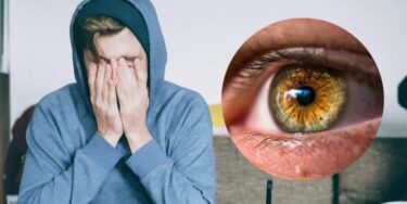 Slika od Stručnjak otkriva kako spriječiti bol u očima zbog predugog boravka ispred ekrana
