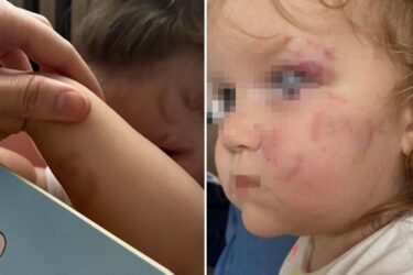 Slika od Strašan slučaj u vrtiću u Srbiji: dijete izgrizlo djevojčicu, s teškim ozljedama hitno je prevezena u bolnicu