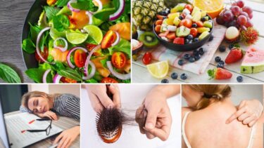 Slika od Umor, akne, opadanje kose… Saznajte kojih vam vitamina nedostaje i kako ih nadoknaditi