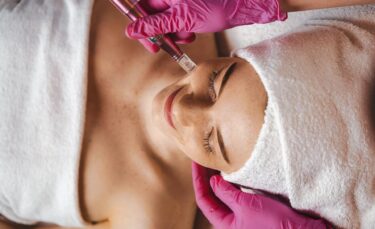 Slika od ‘Vampirski tretman‘ za pomlađivanje kože lica i vlasišta: PRF i mezoterapija