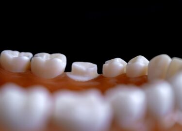 Slika od Kreće testiranje lijeka za regeneraciju izgubljenih zuba