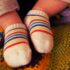 Slika od Liječnik osudio majke koje bebama stavljaju krumpir u čarape