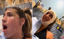 Slika od Nevjerojatna situacija: 21-godišnjakinji ‘zapela’ usta nakon što je prejako zijevnula