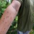 Slika od Hrvatski grad ‘u crvenom’ zbog najezde komaraca, NZJZ izdao nove preporuke