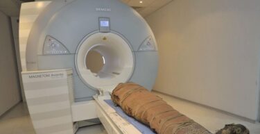 Slika od I mumije idu na CT i magnet. Doktor Čavka: ‘Jednoj smo našli tumor’