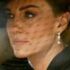 Slika od Kako Kate Middleton nakon kemoterapije nije izgubila kosu? Stigao odgovor koji su svi čekali