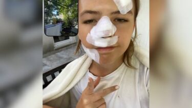 Slika od Mlada Šveđanka ozlijeđena u kaosu ispred splitskog kluba: ‘Imam 15 šavova. Svi su vrištali’