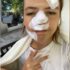 Slika od Mlada Šveđanka ozlijeđena u kaosu ispred splitskog kluba: ‘Imam 15 šavova. Svi su vrištali’