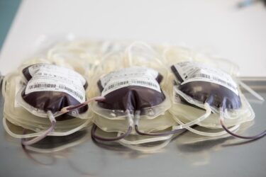 Slika od U Viškovu se organizira dobrovoljno darivanje krvi; Svi koji se pridruže akciji imaju besplatan ulaz u Kuću halubajskega zvončara