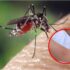 Slika od Ugrizao vas je komarac i svrbi bez prestanka? Dovoljno je mjesto uboda namazati ovim voćem