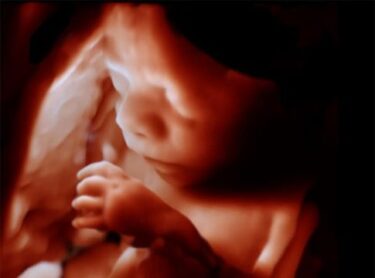 Slika od Kako snimke ultrazvuka utječu na povezivanje roditelja i djece prije njihova rođenja?
