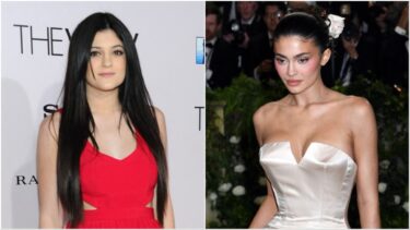 Slika od Transformacija Kylie Jenner kroz godine: Prirodna ljepota ili estetski zahvati?