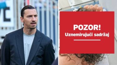 Slika od Ibrahimović rasjekao glavu. Objavio uznemirujuće fotke